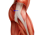 Posterior Approach